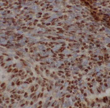 RCVRN Antibody
