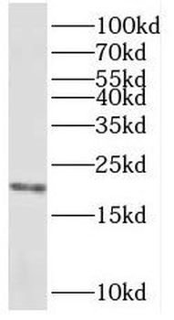 REEP5 Rabbit Polyclonal Antibody