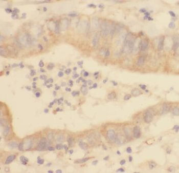 REEP5 Rabbit Polyclonal Antibody
