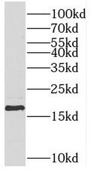 REG4 Rabbit Polyclonal Antibody