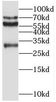 REPS2 Rabbit Polyclonal Antibody