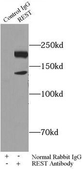 REST Rabbit Polyclonal Antibody
