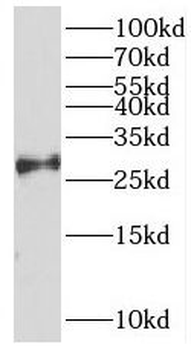 REXO2 Rabbit Polyclonal Antibody