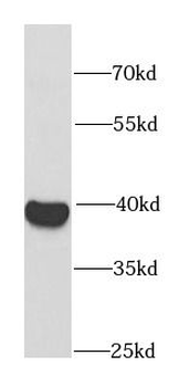 RFC4 Rabbit Polyclonal Antibody