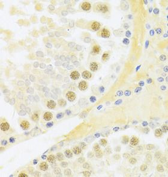RFC4 Rabbit Polyclonal Antibody