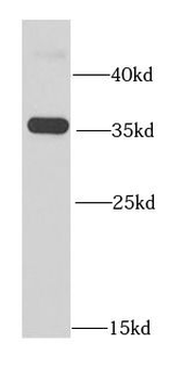 RFC5 Rabbit Polyclonal Antibody