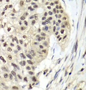 RFC5 Rabbit Polyclonal Antibody
