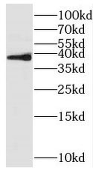 RFFL Rabbit Polyclonal Antibody