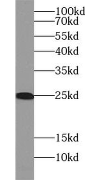 RGS2 Rabbit Polyclonal Antibody