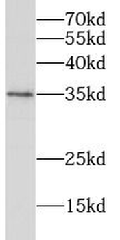 RHBDL2 Rabbit Polyclonal Antibody