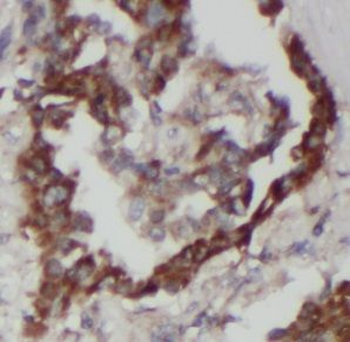 RHCG Rabbit Polyclonal Antibody