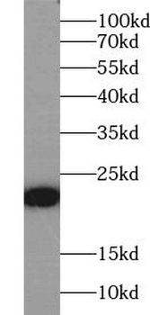 RHOB Rabbit Polyclonal Antibody