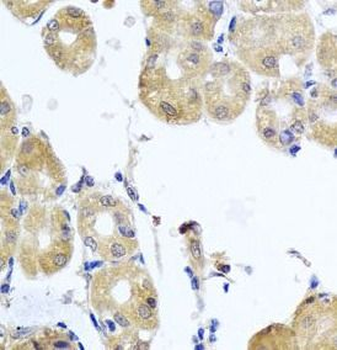 RHOB Rabbit Polyclonal Antibody