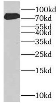 RHPN2 Rabbit Polyclonal Antibody