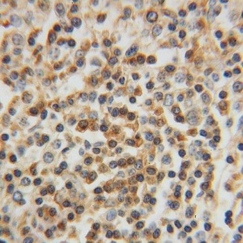 APBB1IP Rabbit Polyclonal Antibody