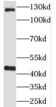 RIMBP2 Rabbit Polyclonal Antibody