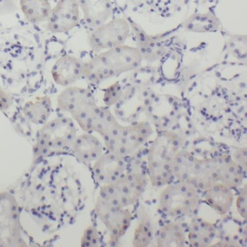 RIMBP2 Rabbit Polyclonal Antibody