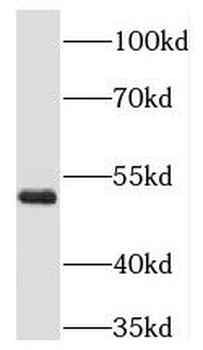 RING1 Rabbit Polyclonal Antibody