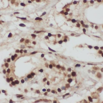 RING1 Rabbit Polyclonal Antibody
