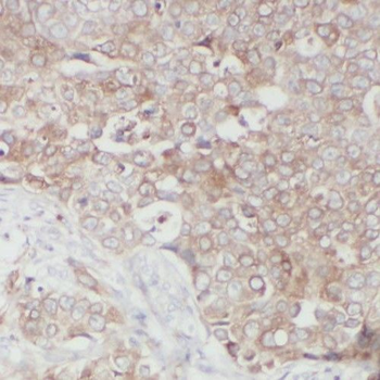 RINT1 Rabbit Polyclonal Antibody