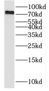 RMI1 Rabbit Polyclonal Antibody