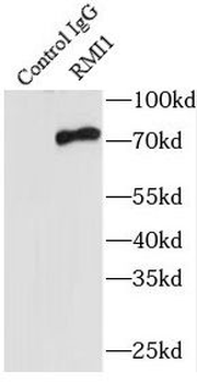RMI1 Rabbit Polyclonal Antibody