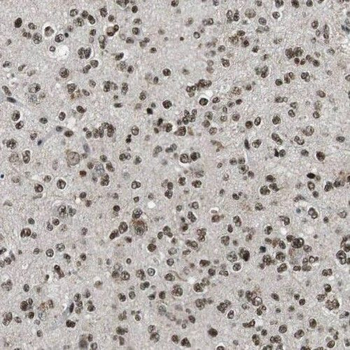 RMI1 Rabbit Polyclonal Antibody