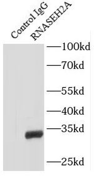 RNASEH2A Rabbit Polyclonal Antibody