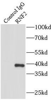 RNF2 Antibody