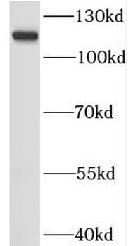 RNF20 Rabbit Polyclonal Antibody