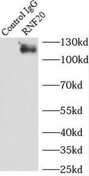 RNF20 Rabbit Polyclonal Antibody
