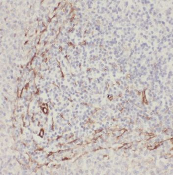 RNF213 Rabbit Polyclonal Antibody