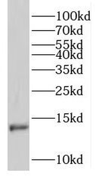 RNF7 Rabbit Polyclonal Antibody