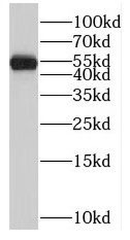 RORB Rabbit Polyclonal Antibody