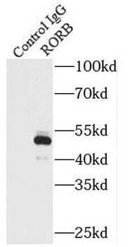 RORB Rabbit Polyclonal Antibody