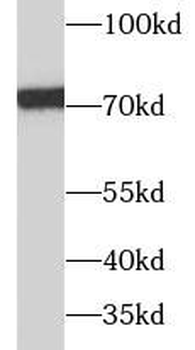 RPA1 Rabbit Polyclonal Antibody