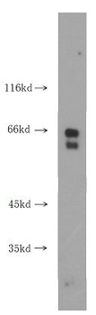 RPE65 Antibody