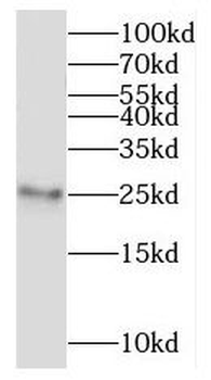 RPL10A Rabbit Polyclonal Antibody