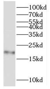 RPL11 Antibody