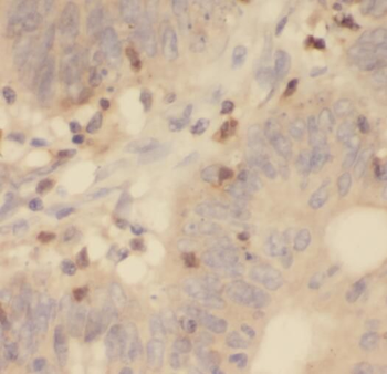 RPL13 Rabbit Polyclonal Antibody