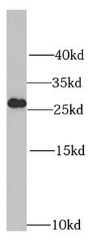 RPL14 Rabbit Polyclonal Antibody
