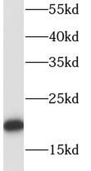 RPL18A Rabbit Polyclonal Antibody