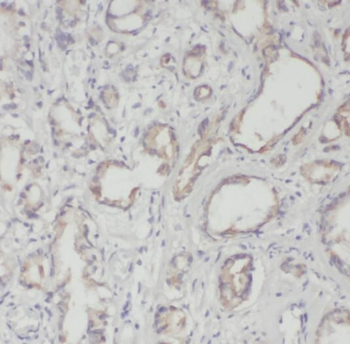 RPL18A Rabbit Polyclonal Antibody