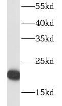 RPL18A Rabbit Polyclonal Antibody