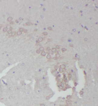 RPL18A Rabbit Polyclonal Antibody