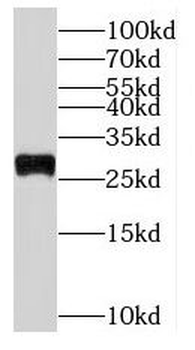RPL19 Rabbit Polyclonal Antibody