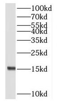 RPL23 Rabbit Polyclonal Antibody