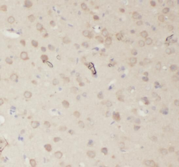 RPL23 Rabbit Polyclonal Antibody
