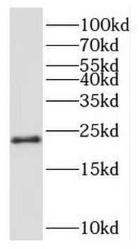 RPL24 Rabbit Polyclonal Antibody