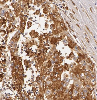 RPL27 Rabbit Polyclonal Antibody